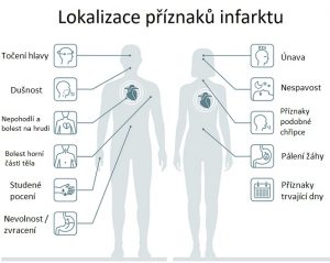 Srdeční infarkt Infarkt myokardu příčiny příznaky a léčba