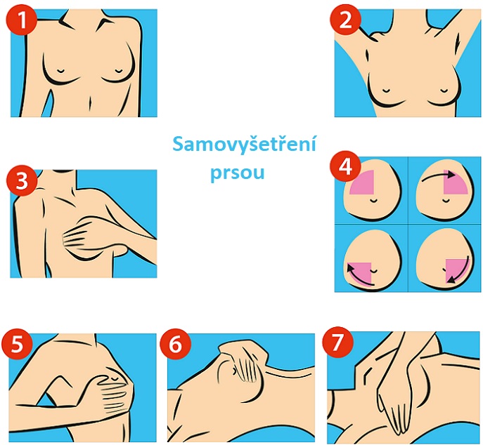 Postup samovyšetření prsou