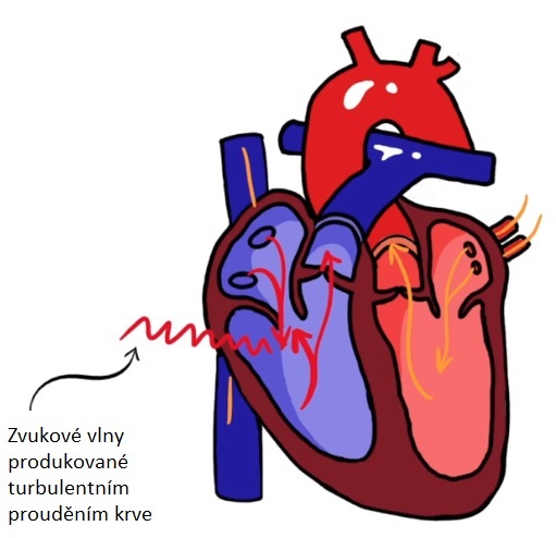 Systolické šelesty mohou mít různé charakteristiky, které pomáhají lékařům diagnostikovat konkrétní příčinu.