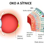 Centrální serózní retinopatie – příznaky, příčiny a léčba