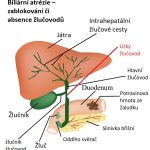 Biliární atrézie – zablokování či absence žlučovodů – příznaky, příčiny a léčba