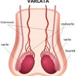 Orchiektomie – odstranění jednoho nebo obou varlat – jak a proč se provádí?