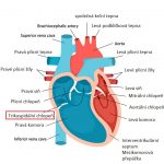 Ebsteinova anomálie – vrozená srdeční vada – příznaky, příčiny a léčba