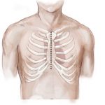 Sternotomie – otevření hrudní kosti pro přístup k orgánům v hrudní dutině