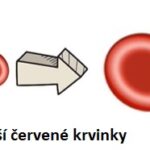 Makrocytární anémie – příznaky, příčiny a léčba