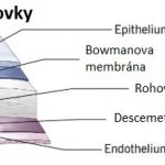 Fuchsova dystrofie – příznaky, příčiny a léčba