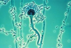 Aspergillus fumigatus