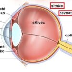 Chorioretinitida – zánětlivé onemocnění oka – příznaky, příčiny a léčba