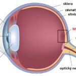 Cystoidní makulární edém – příznaky, příčiny a léčba